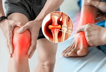 Diz eklemi ve ayak bölgesine Icexin jeli uygulama şeması