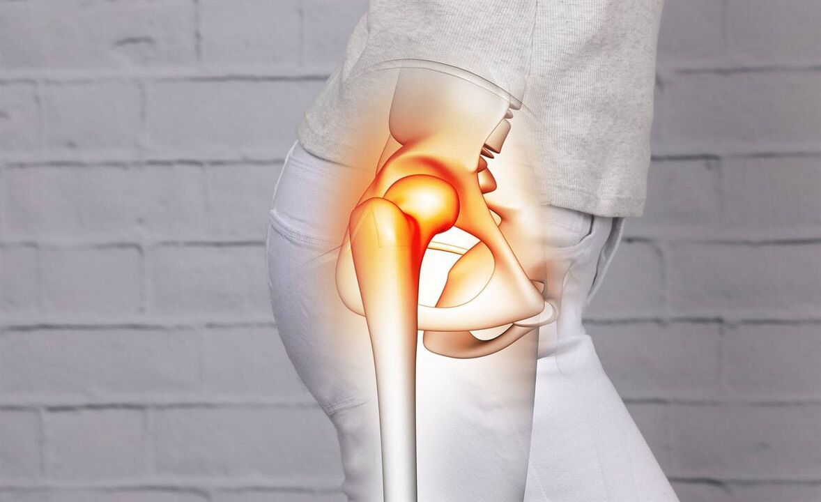 kalça ağrısı